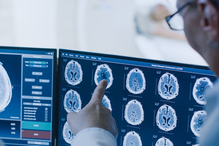Neurology Scans